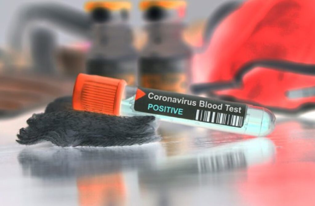 allerta in Italia per il diffondersi del coronavirus