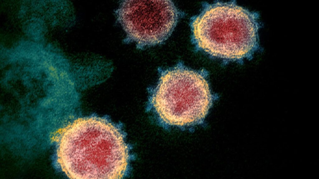 sars-coV-2-coronavirus
